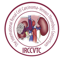 IRCCVTC