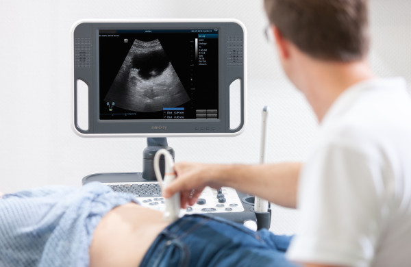 Ultraschalluntersuchung am Bauch, im Hintergrund der Monitor des Geräts